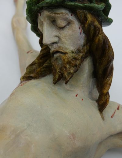 Lesena plastika po končanem posegu